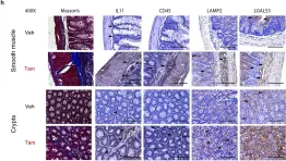 Fig.2.H showing Immunohistochemistry in a Mus musculus (House mouse) sample from the publication: Transgenic interleukin 11 expression causes cross-tissue fibro-inflammation and an inflammatory bowel phenotype in mice.