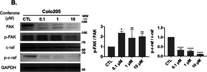 Fig.2.B showing Western Blotting from the publication: Inhibitory Activity of Conferone on FAK Activity and Glutamine Metabolism in Human Colorectal Cancer.