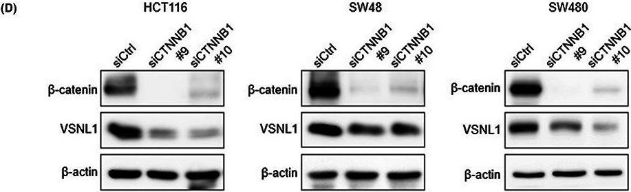 Fig.1.D showing Western Blotting in a Homo sapiens (Human) sample from the publication: Visinin-like 1, a novel target gene of the Wnt/β-catenin signaling pathway, is involved in apoptosis resistance in colorectal cancer.