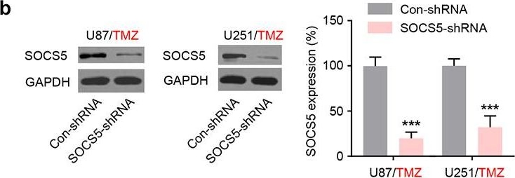 Fig.3.B showing Western Blotting in a Homo sapiens (Human) sample from the publication: SOCS5 contributes to temozolomide resistance in glioblastoma by regulating Bcl-2-mediated autophagy.