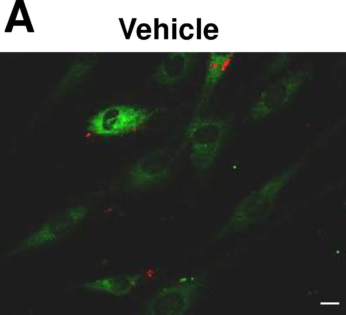 Cellular localization and associations of the major lipolytic proteins in human skeletal muscle at rest and during exercise.