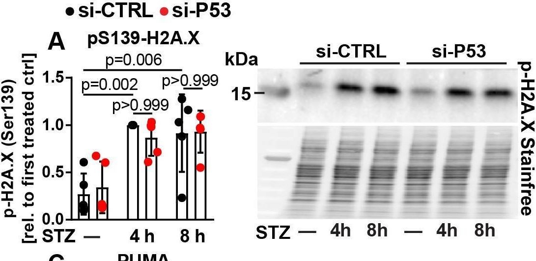Fig.1.A showing Western Blotting from the publication: ATM and P53 differentially regulate pancreatic beta cell survival in Ins1E cells.