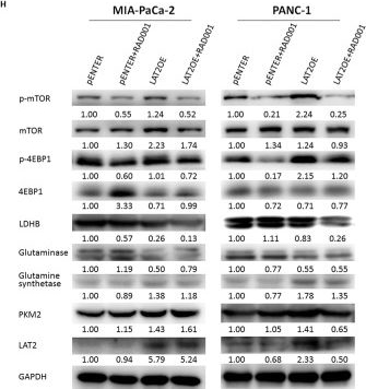 Fig.5.H showing Western Blotting in a Homo sapiens (Human) sample from the publication: LAT2 regulates glutamine-dependent mTOR activation to promote glycolysis and chemoresistance in pancreatic cancer.