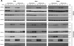 Fig.6.A showing Western Blotting from the publication: Spatiotemporal processing of neural cell adhesion molecules 1 and 2 by BACE1 in vivo.