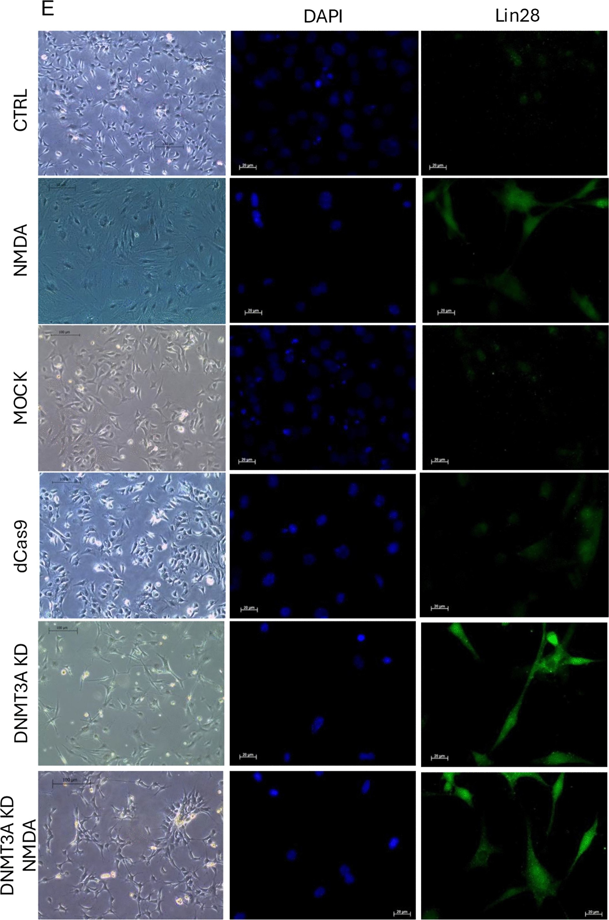 Fig.2.E showing Immunocytochemistry-immunofluorescence from the publication: Targeted knockdown of DNA methyltransferase 3a (DNMT3a) unlocks dedifferentiation and neurogenic potential in mouse retinal Müller glia.