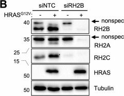 Fig.7.B showing Western Blotting from the publication: Human RNase H2 upregulation counteracts oncogene- and chemotherapy-induced replication stress.