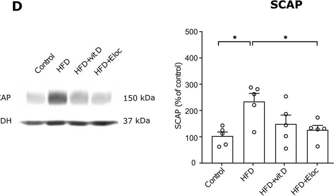 Fig.4.D showing Western Blotting in a Mus musculus (House mouse) sample from the publication: Elocalcitol, a fluorinated vitamin D derivative, prevents high-fat diet-induced obesity via SCAP downregulation and miR-146a-associated mechanisms.