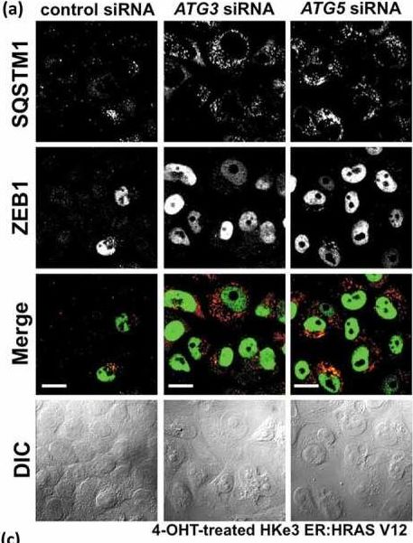 Autophagy inhibition specifically promotes epithelial-mesenchymal transition and invasion in RAS-mutated cancer cells.