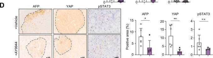 Fig.5.D showing Immunohistochemistry in a Mus musculus (House mouse) sample from the publication: DHCR7 inhibition ameliorates MetALD and HCC in mice and human 3D liver spheroids.