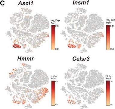 Fig.2.C showing Immunohistochemistry in a Homo sapiens (Human) sample from the publication: The Identification of CELSR3 and Other Potential Cell Surface Targets in Neuroendocrine Prostate Cancer.