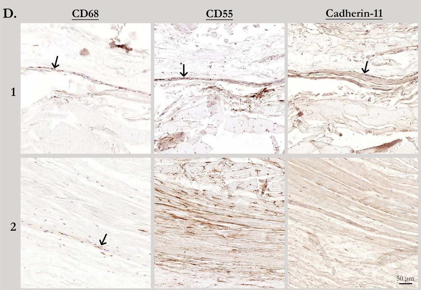 Fig.1.D showing Immunohistochemistry from the publication: Evidence for the presence of synovial sheaths surrounding the extensor tendons at the metacarpophalangeal joints: a microscopy study.