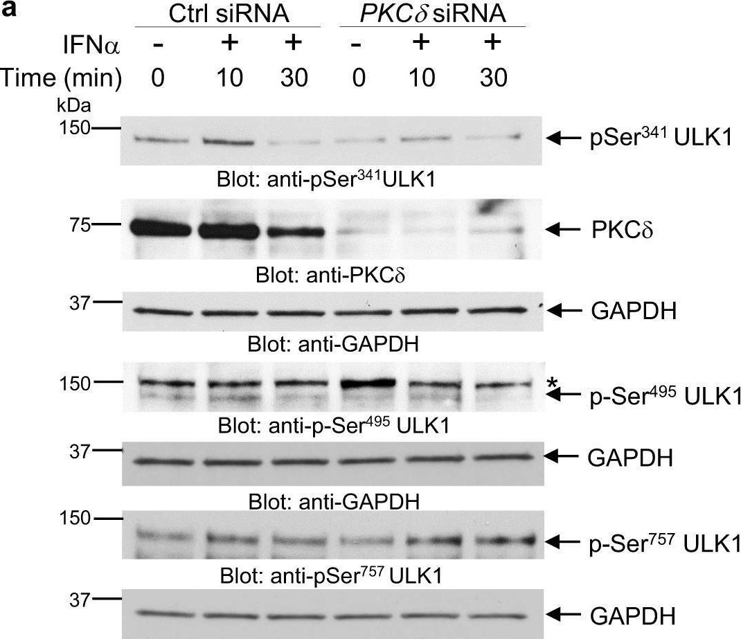 Fig.2.A showing Western Blotting in a Homo sapiens (Human) sample from the publication: Discovery of a signaling feedback circuit that defines interferon responses in myeloproliferative neoplasms.