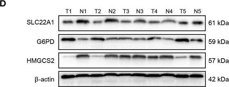 Fig.7.D showing Western Blotting from the publication: Identification of the Tumor Immune Microenvironment and Therapeutic Biomarkers by a Novel Molecular Subtype Based on Aging-Related Genes in Hepatocellular Carcinoma.