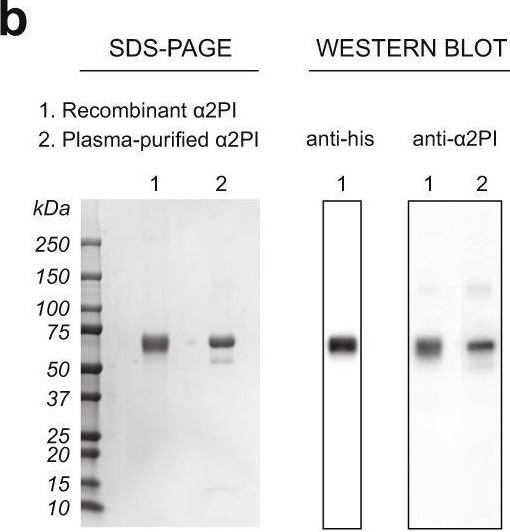 Fig.1.B showing Western Blotting from the publication: Therapeutic use of α2-antiplasmin as an antifibrinolytic and hemostatic agent in surgery and regenerative medicine.