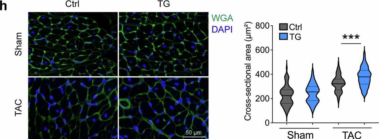 Fig.2.H from the publication: Characterization of ferroptosis-triggered pyroptotic signaling in heart failure.