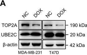 Fig.3.A showing Western Blotting in a Homo sapiens (Human) sample from the publication: Inhibition of UBE2C Promotes Parkin-Mediated K63-Linked Ubiquitination of TOP2A to Induce Senescence and Increase Sensitivity of Doxorubicin in Breast Cancer.
