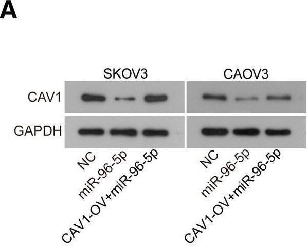 Fig.5.A showing Western Blotting from the publication: miR-96-5p promotes the proliferation and migration of ovarian cancer cells by suppressing Caveolae1.