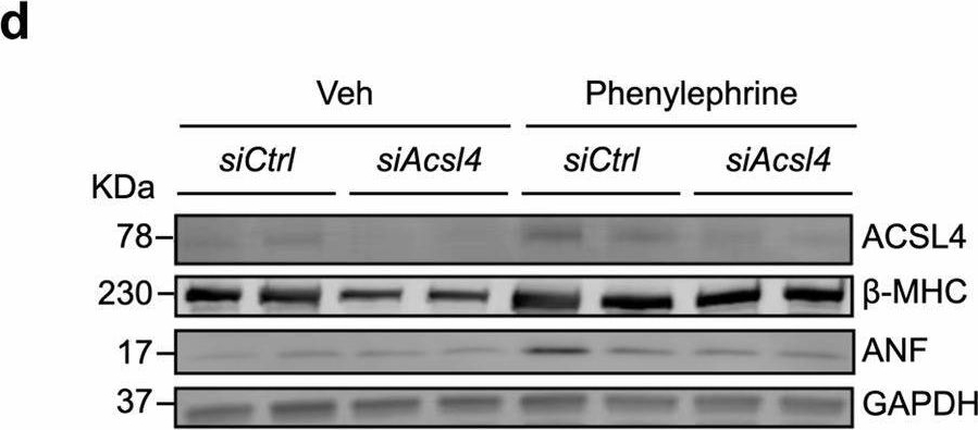 Fig.4.D showing Western Blotting in a Rattus norvegicus (Rat) sample from the publication: Characterization of ferroptosis-triggered pyroptotic signaling in heart failure.