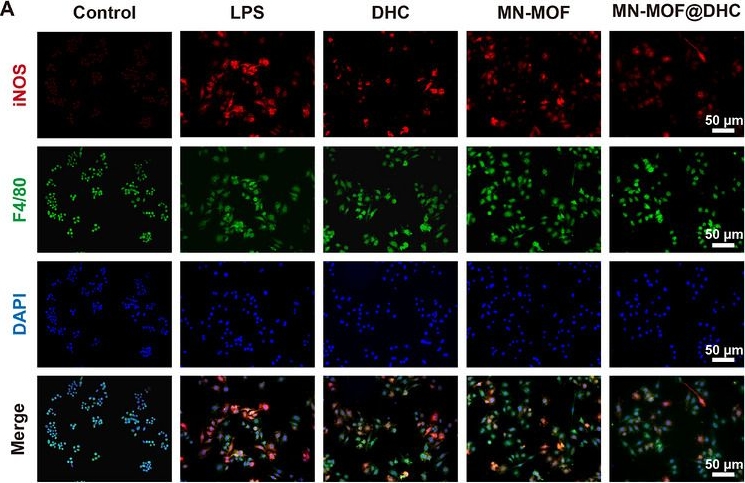 Fig.3.A showing Immunocytochemistry-immunofluorescence from the publication: Sustained-Release Ulcer-Protective Microarray Patch With Dihydrocapsaicin for Diabetic Wound Regeneration.