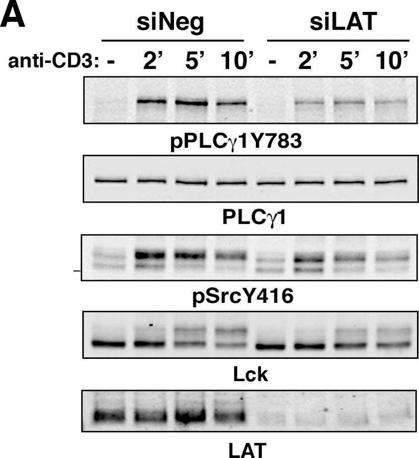 Fig.3.A showing Western Blotting in a Homo sapiens (Human) sample from the publication: T cell receptor signal initiation induced by low-grade stimulation requires the cooperation of LAT in human T cells.