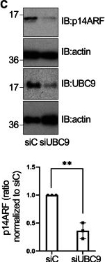 Fig.4.G showing Western Blotting from the publication: SUMOylation of the lysine-less tumor suppressor p14ARF counters ubiquitylation-dependent degradation.