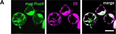 Fig.6.A from the publication: X-ray irradiation triggers immune response in human T-lymphocytes via store-operated Ca2+ entry and NFAT activation.