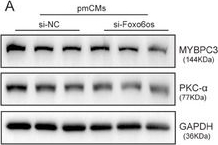 Fig.7.A showing Western Blotting in a Mus musculus (House mouse) sample from the publication: LncRNA Foxo6os as a Novel " Scaffold" Mediates MYBPC3 in Combating Pathological Cardiac Hypertrophy and Heart Failure.