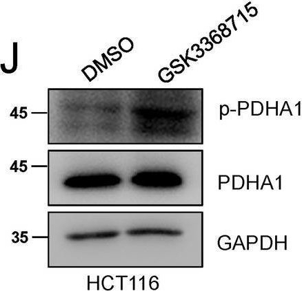 Fig.4.J showing Western Blotting in a Homo sapiens (Human) sample from the publication: PRMT1-mediated PGK1 arginine methylation promotes colorectal cancer glycolysis and tumorigenesis.