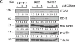 Fig.2.C showing Western Blotting from the publication: EZH2 regulates cofilin activity and colon cancer cell migration by targeting ITGA2 gene.