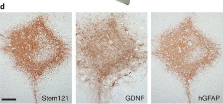Fig.2.D showing Immunohistochemistry from the publication: Transplantation of human neural progenitor cells secreting GDNF into the spinal cord of patients with ALS: a phase 1/2a trial.