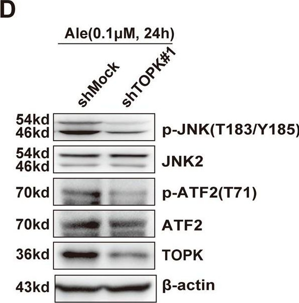 Fig.5.D showing Western Blotting in a Homo sapiens (Human) sample from the publication: Inhibiting ALK-TOPK signaling pathway promotes cell apoptosis of ALK-positive NSCLC.