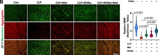 Fig.6.B showing Immunohistochemistry-immunofluorescence from the publication: Cardiac-targeted delivery of nuclear receptor RORα via ultrasound targeted microbubble destruction optimizes the benefits of regular dose of melatonin on sepsis-induced cardiomyopathy.