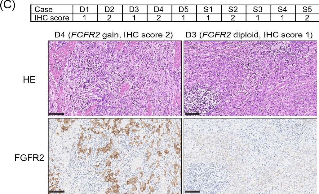 Fig.4.C showing Immunohistochemistry in a Homo sapiens (Human) sample from the publication: Tumor cell enrichment by tissue suspension improves sensitivity to copy number variation in diffuse gastric cancer with low tumor content.