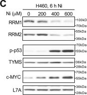 Fig.4.C showing Western Blotting in a Homo sapiens (Human) sample from the publication: Atypical genotoxicity of carcinogenic nickel(II): Linkage to dNTP biosynthesis, DNA-incorporated rNMPs, and impaired repair of TOP1-DNA crosslinks.