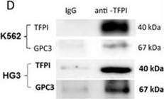 Fig.4.D showing Western Blotting from the publication: Tissue factor pathway inhibitor upregulates CXCR7 expression and enhances CXCL12-mediated migration in chronic lymphocytic leukemia.