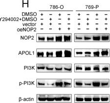 Fig.7.H showing Western Blotting in a Homo sapiens (Human) sample from the publication: NOP2-mediated 5-methylcytosine modification of APOL1 messenger RNA activates PI3K-Akt and facilitates clear cell renal cell carcinoma progression.