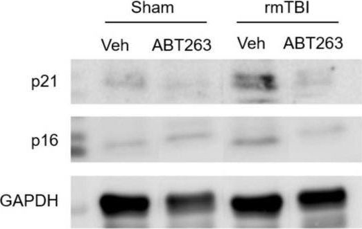 Fig.7.A showing Western Blotting in a Mus musculus (House mouse) sample from the publication: Neurons and glial cells acquire a senescent signature after repeated mild traumatic brain injury in a sex-dependent manner.