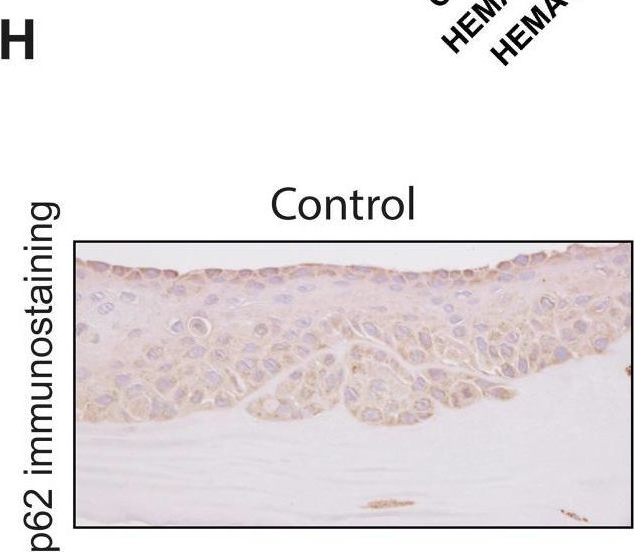 Investigation of biological effects of HEMA in 3D-organotypic co-culture models of normal and malignant oral keratinocytes.
