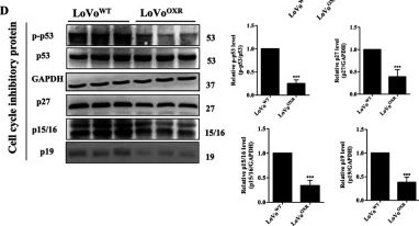 Fig.4.D showing Western Blotting in a Homo sapiens (Human) sample from the publication: miR-100-5p Enhances Cell Cycle-Mediated Chemoresistance by Modulating the CTDSPL/pRB/E2F1 Signaling Pathway in Oxaliplatin-Resistant Colorectal Cancer Cells.
