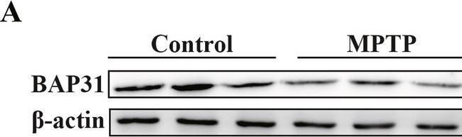 Fig.1.A showing Western Blotting from the publication: BAP31 represses endoplasmic reticulum stress-mediated apoptosis and alleviates neurodegeneration in Parkinson's disease.