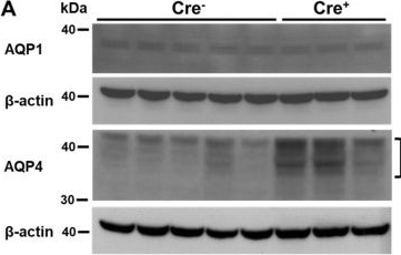 Fig.5.A showing Western Blotting in a Mus musculus (House mouse) sample from the publication: Sulfatide Deficiency, an Early Alzheimer's Lipidomic Signature, Causes Brain Ventricular Enlargement in the Absence of Classical Neuropathological Hallmarks.