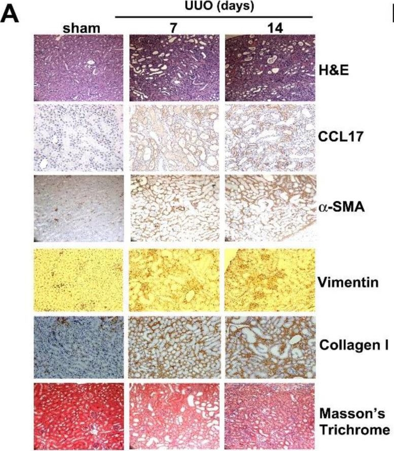 Fig.5.A showing Immunohistochemistry in a Mus musculus (House mouse) sample from the publication: C-C Motif Chemokine Ligand-17 as a Novel Biomarker and Regulator of Epithelial Mesenchymal Transition in Renal Fibrogenesis.