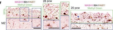 Fig.1.F showing Immunohistochemistry in a Homo sapiens (Human) sample from the publication: Microglial Characterization in Transient Human Neurodevelopmental Structures.