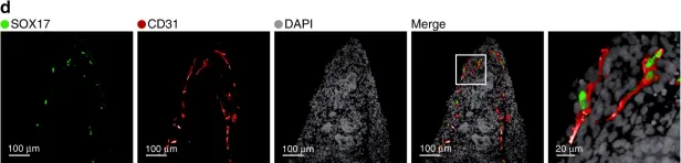Fig.4.D showing Immunohistochemistry in a Homo sapiens (Human) sample from the publication: Single cell census of human kidney organoids shows reproducibility and diminished off-target cells after transplantation.
