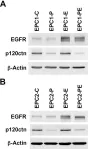 Fig.1.A showing Western Blotting from the publication: Loss of p120ctn causes EGFR-targeted therapy resistance and failure.