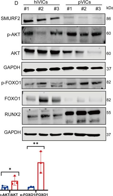 Fig.2.D showing Western Blotting in a Homo sapiens (Human) sample from the publication: Construction of a Three-Dimensional Calcific Aortic Valve Disease Model Using Human iPSC-Derived Valvular Interstitial Cells.