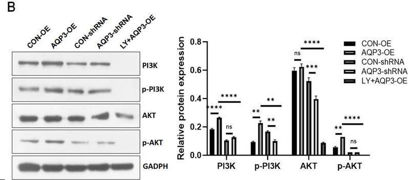 Fig.2.B showing Western Blotting in a Homo sapiens (Human) sample from the publication: AQP3 Influences Unexplained Recurrent Abortion by Regulating Trophoblast Cell Migration and Invasion via the METTL14/IGF2BP1/AQP3/PI3K/AKT Pathway.