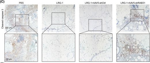 Fig.7.C showing Immunohistochemistry from the publication: LRG-1 promotes fat graft survival through the RAB31-mediated inhibition of hypoxia-induced apoptosis.
