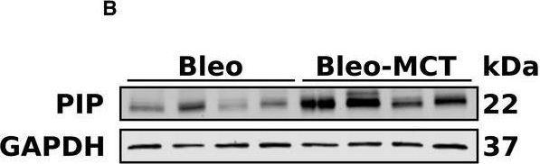 Fig.6.B showing Western Blotting in a Homo sapiens (Human) sample from the publication: Histological hallmarks and role of Slug/PIP axis in pulmonary hypertension secondary to pulmonary fibrosis.