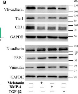 Fig.5.B showing Western Blotting from the publication: Melatonin Promotes Heterotopic Ossification Through Regulation of Endothelial-Mesenchymal Transition in Injured Achilles Tendons in Rats.